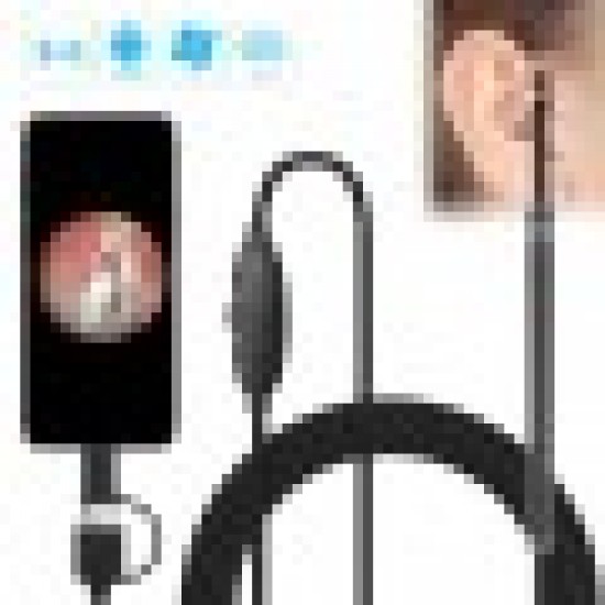 Dispozitiv de curatat urechi Video HD - Dispozitive electronice - oferit de sellsell.ro
