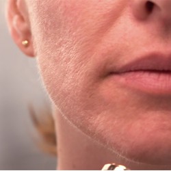 Dispozitiv pentru indepartarea parului facial Wellneo Flawless + Masca fata CADOU